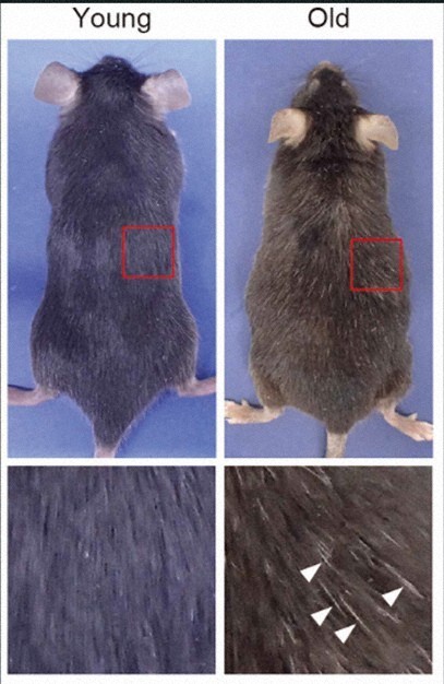 😱白发竟是身体的自我保护？顶尖大学最新发现！