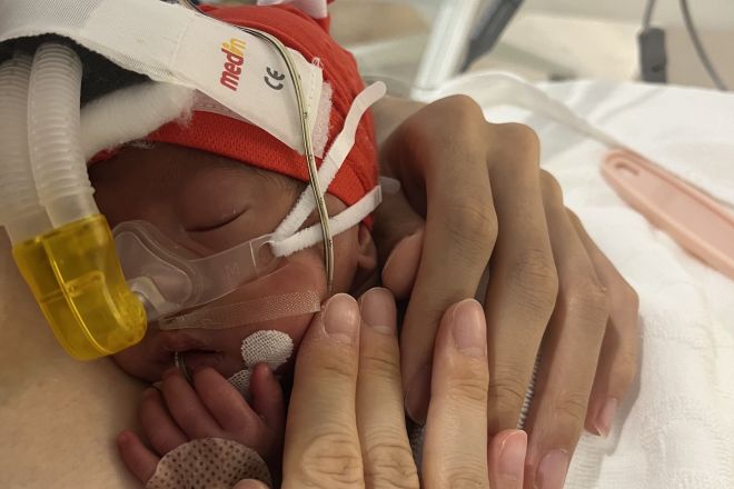 👶命悬一线!22周早产儿,妈妈的爱奇迹逆转!