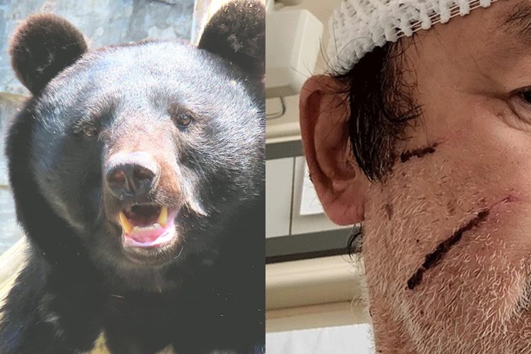 ⚠️熊出没！😱 狂暴袭击，专咬脸！一天6伤！