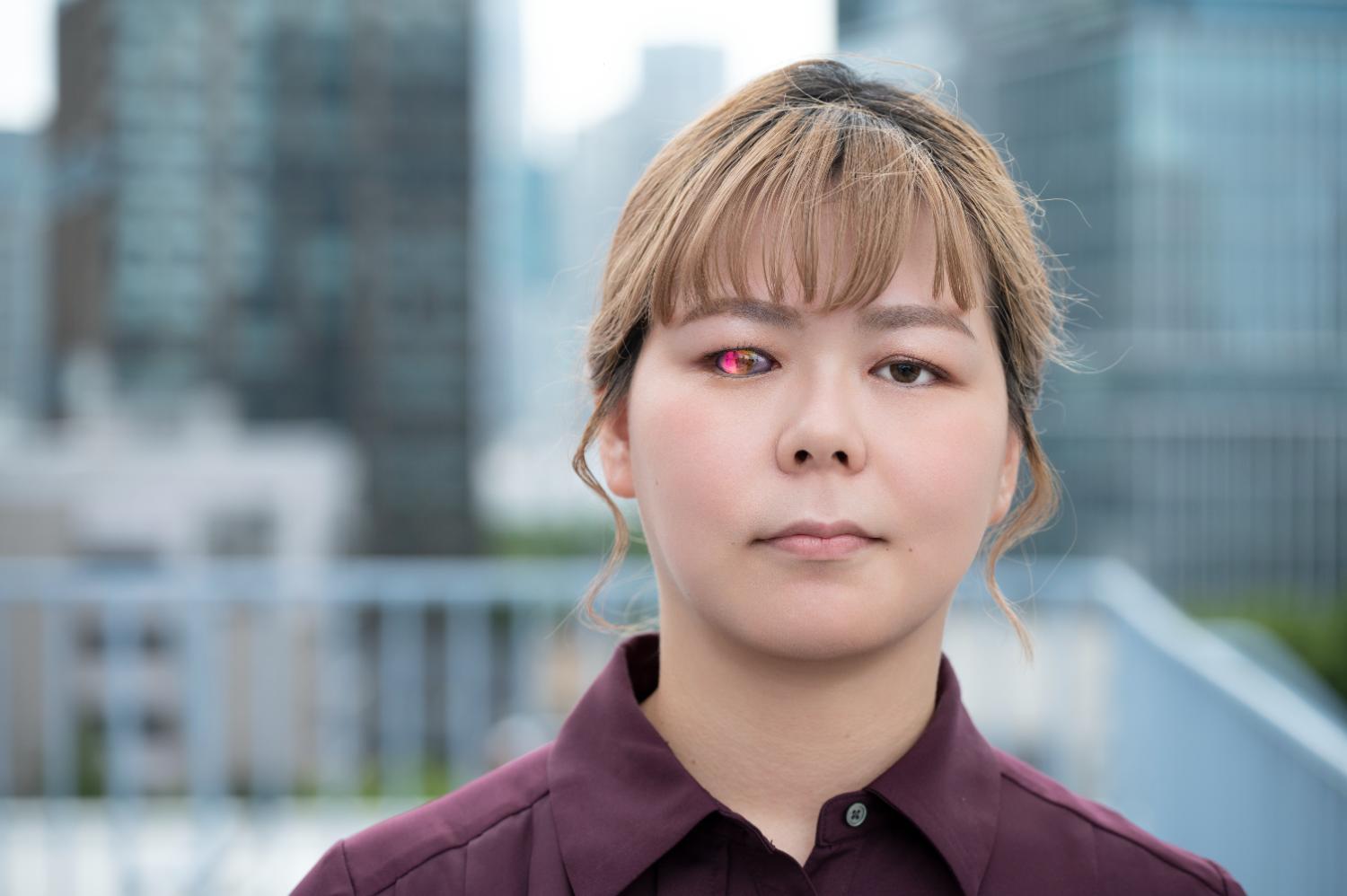 💥眼球里扎了玻璃，一周后…失明少女的痛彻心声！