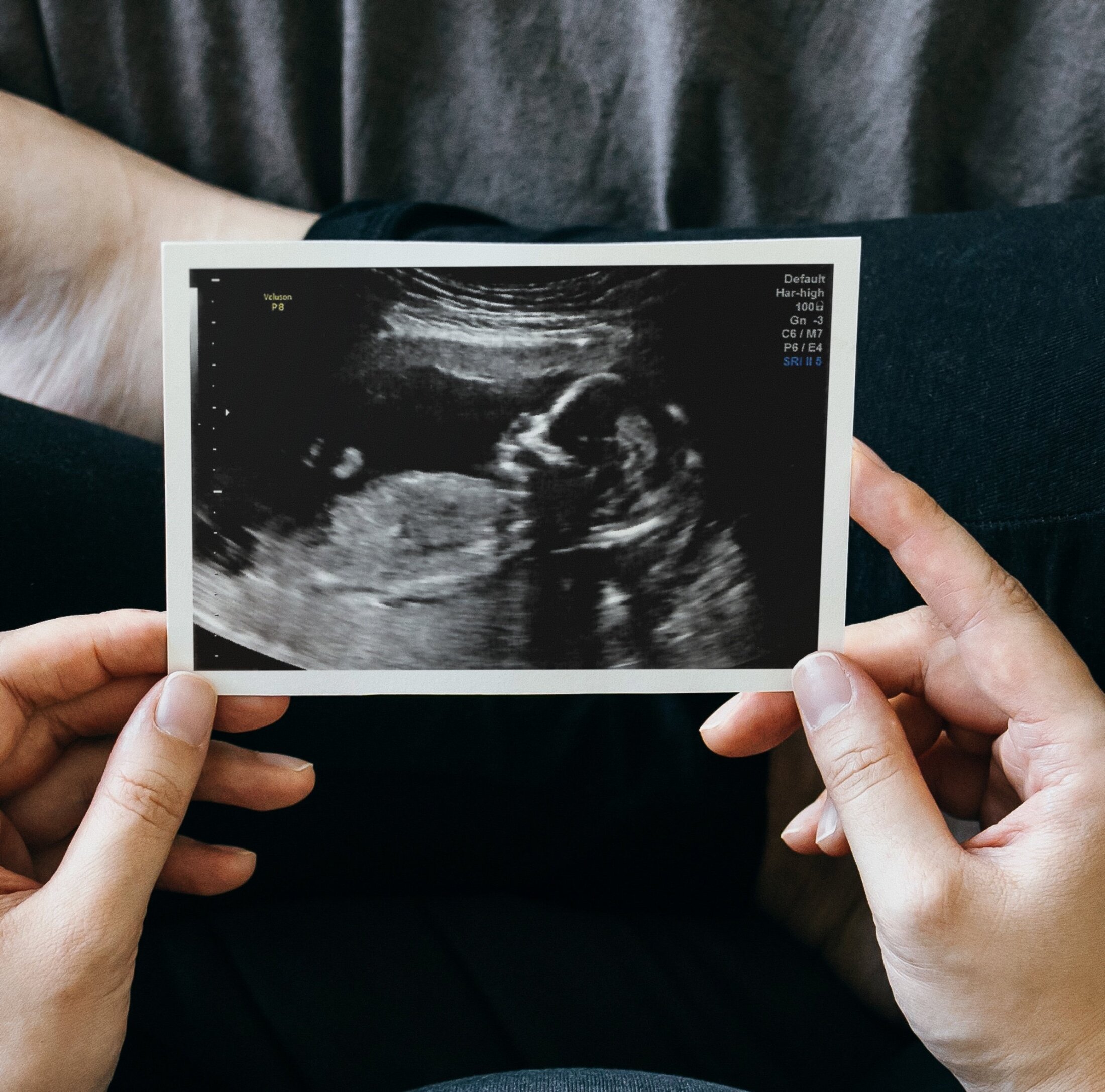 🤰六旬夫突发“第三回合”，46岁我竟怀孕了？！生还是不生？