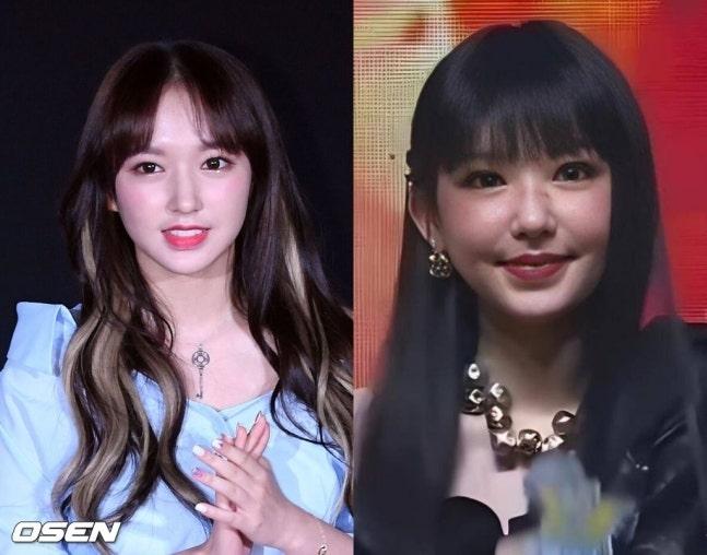 😱宇宙少女孙素，颜值崩塌？疑因药物副作用！