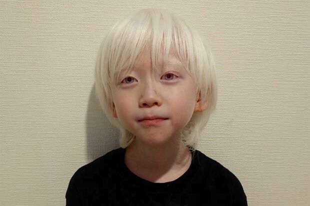 💔儿子罕病成“展览”，妈妈的逆袭！