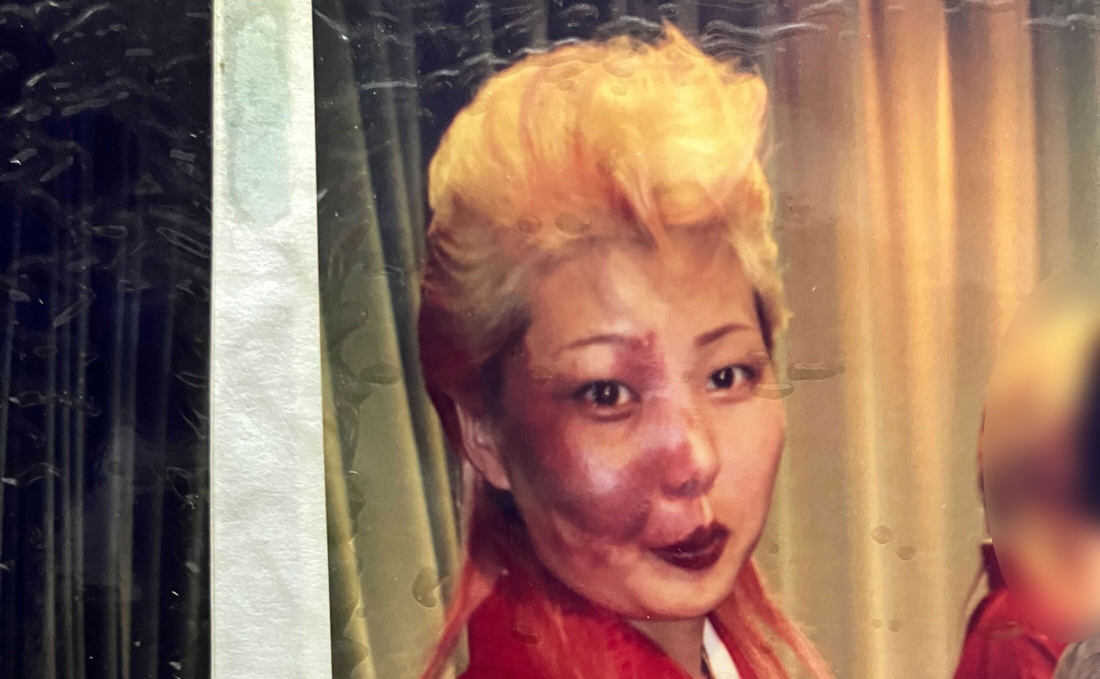 💥天生带伤,却勇敢说出真相!