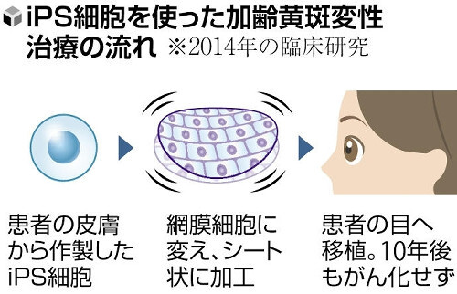 ✨失明边缘，她重见光明！10年仍安然无恙！