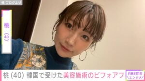 😱40岁阿姨，整容3次！回国后…竟发生这种事！ 封面