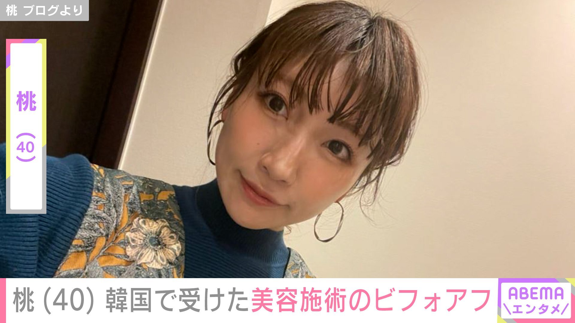 😱40岁阿姨，整容3次！回国后…竟发生这种事！