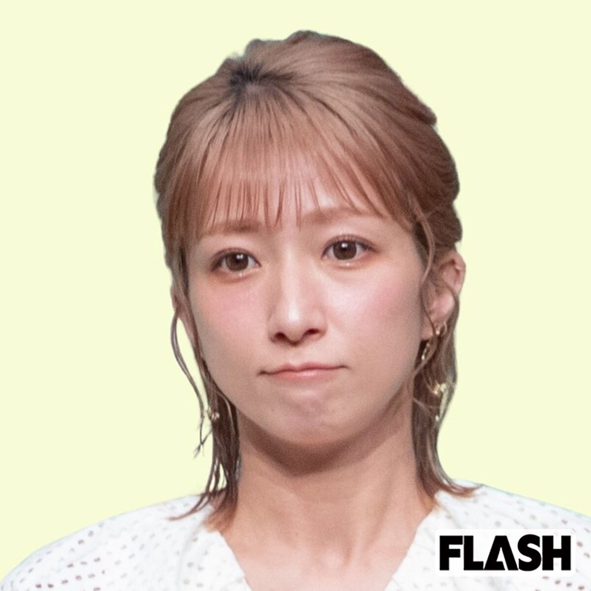 💥辻希美：眼前一片模糊，却还要营业？（SmartFLASH）