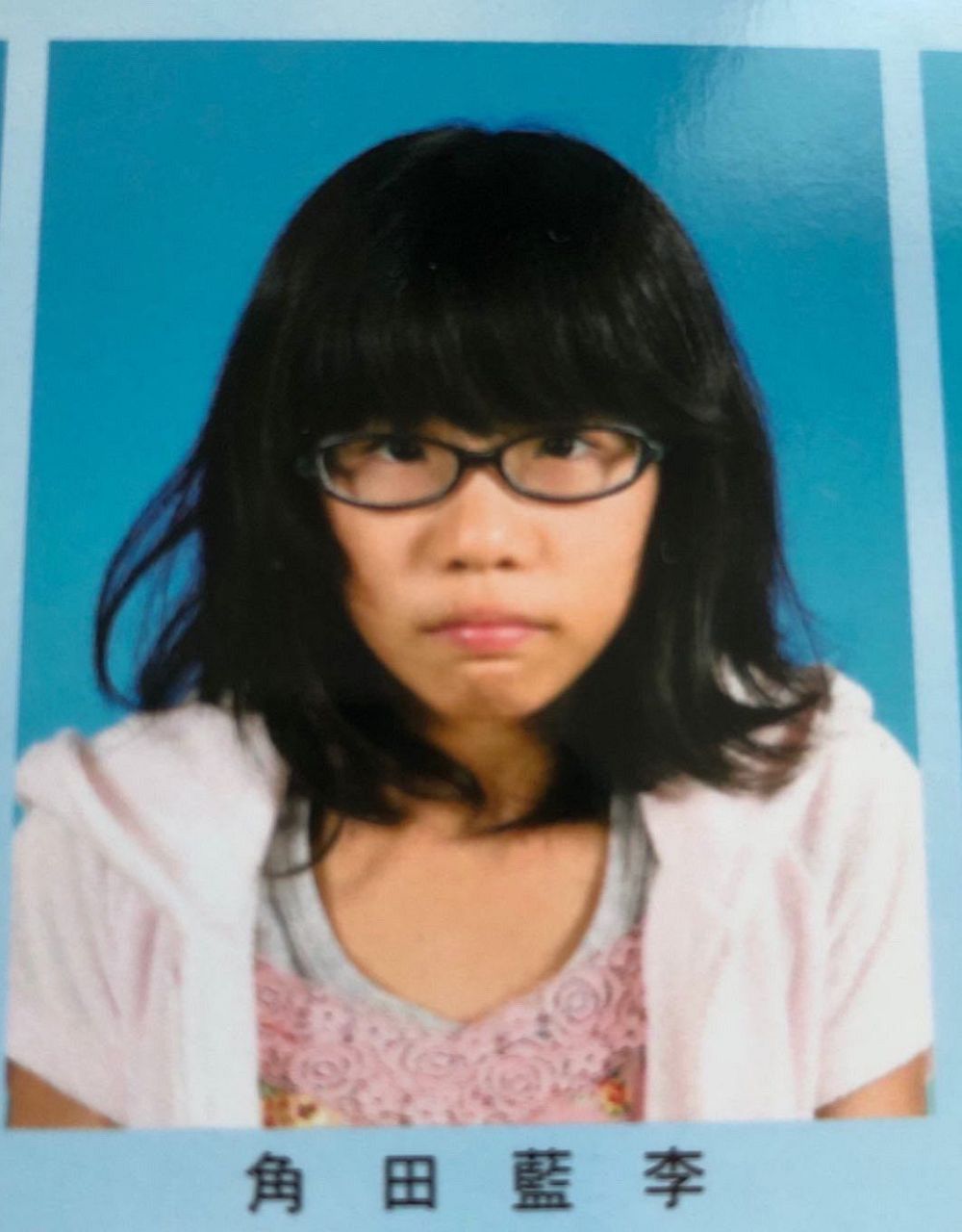 ✨28岁模特花2600万“逆袭”！整形前后对比惊呆你！😱