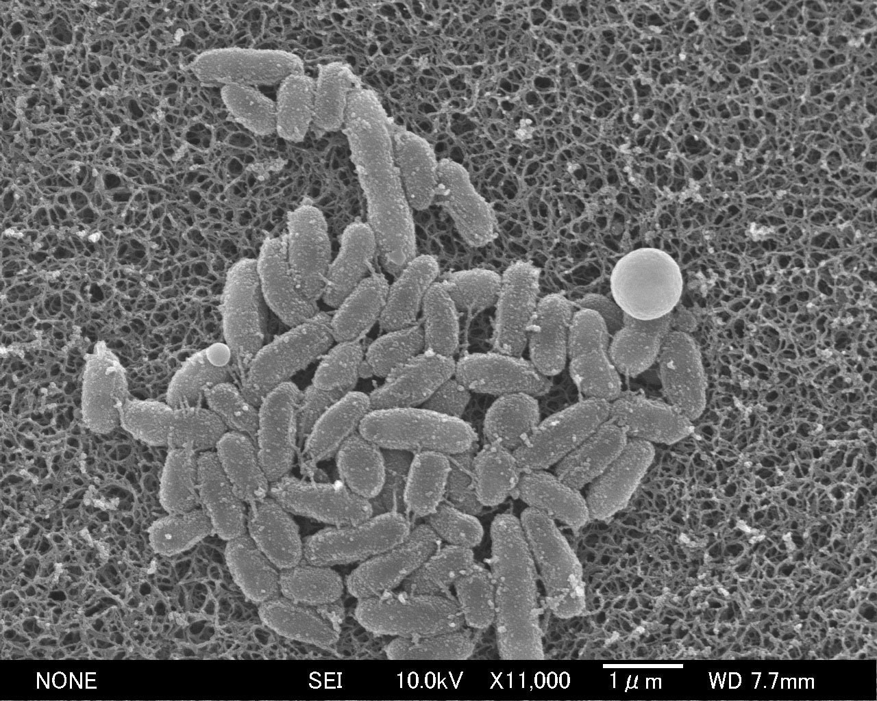 🚨百日咳卷土重来！抗药菌占比8成，治疗难！