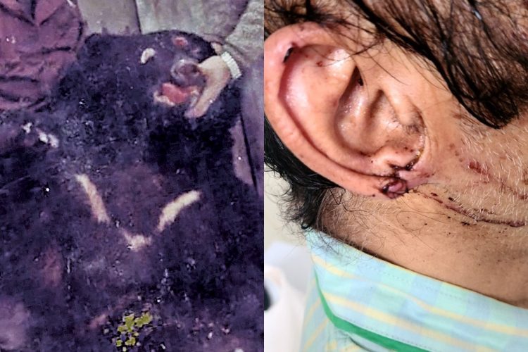 ⚠️熊爪下的惨叫！少女遇害细节曝光，为何熊害频发？