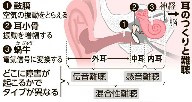 👂听不见的绝望？人工耳蜗，重拾声音的希望！