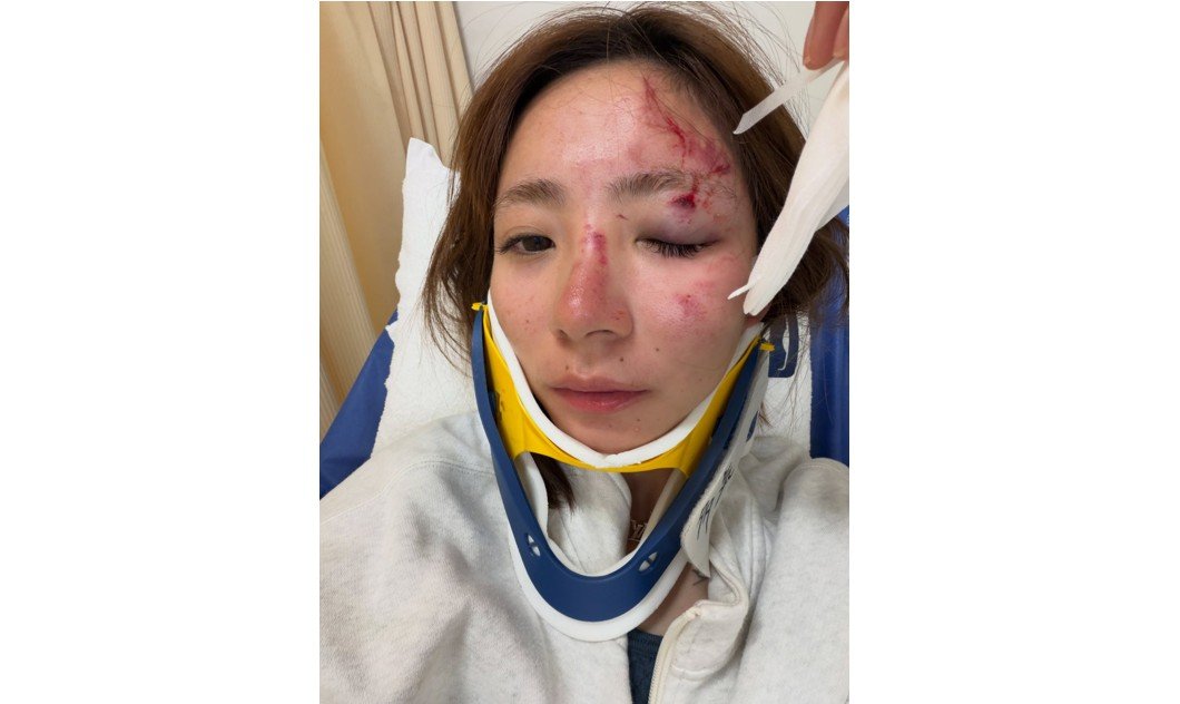 🚨命悬一线！iPhone救了爱豆！