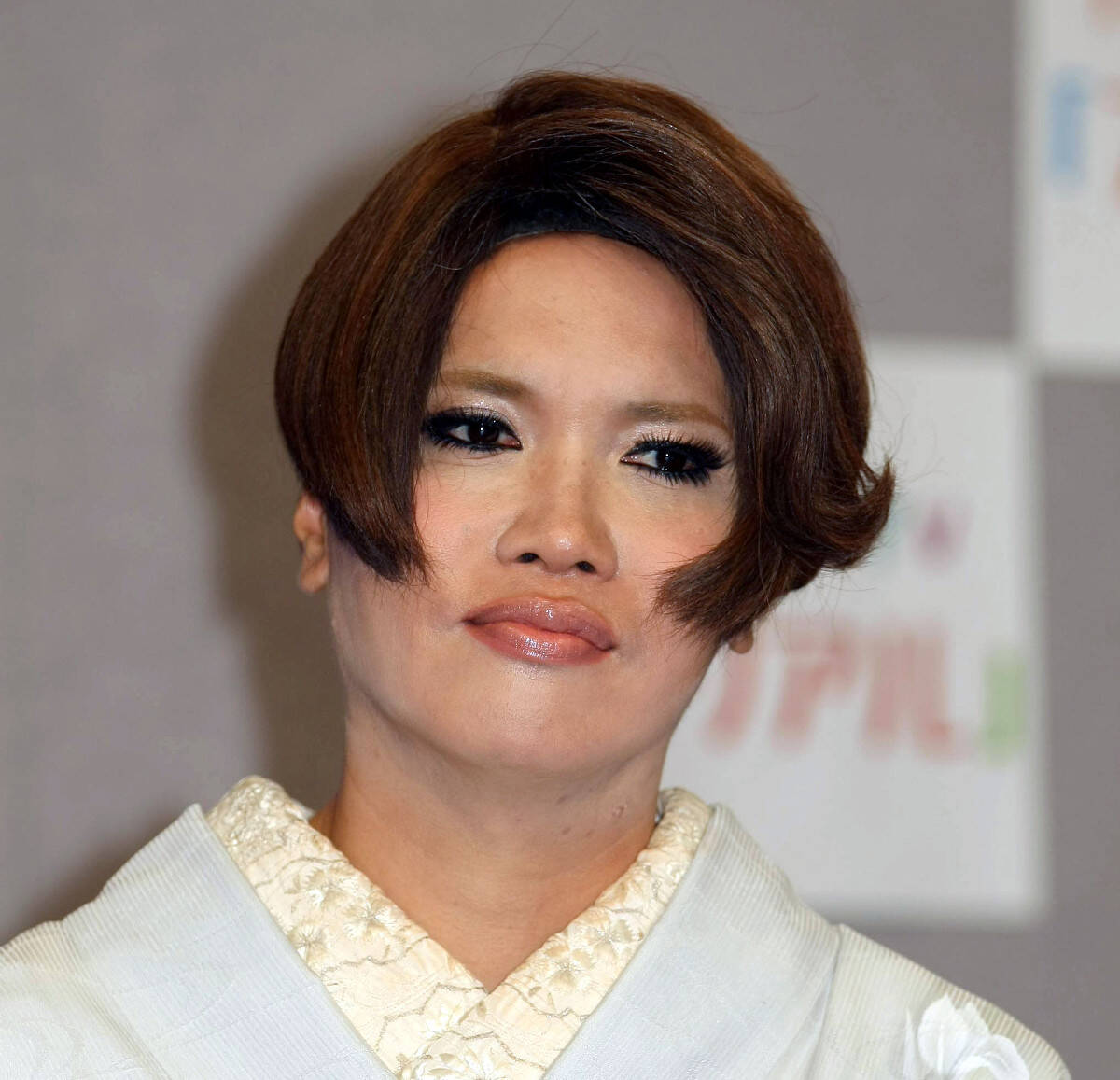 🚨眉飞三尺！IKKO面瘫康复，重返工作！