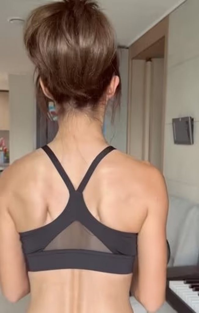 🚨韩星接连自曝“白斑”：无药可救，颜值焦虑！