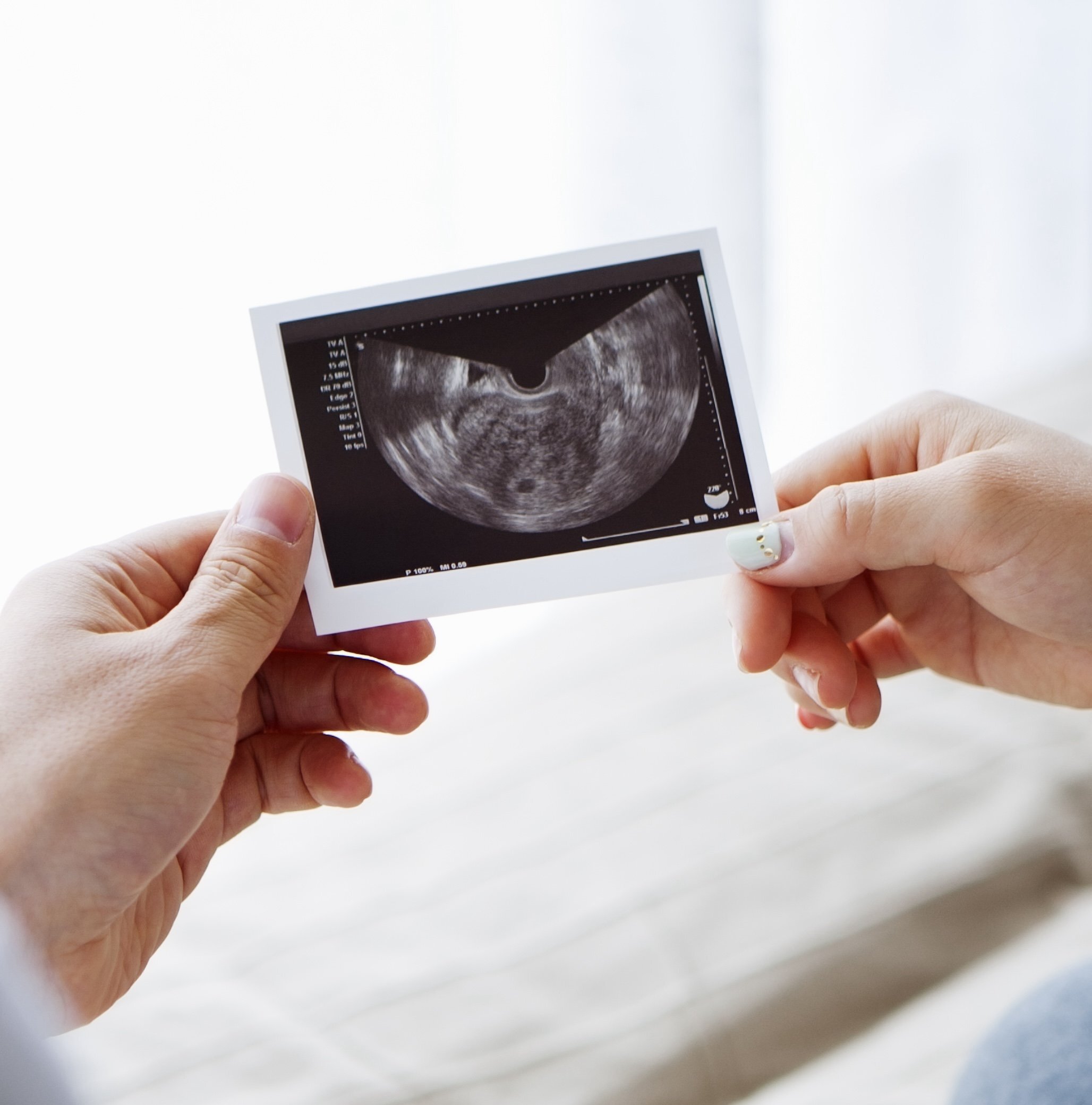 👶 48岁妈妈再怀孕，27岁女儿泪崩！这剧情反转太刺激！