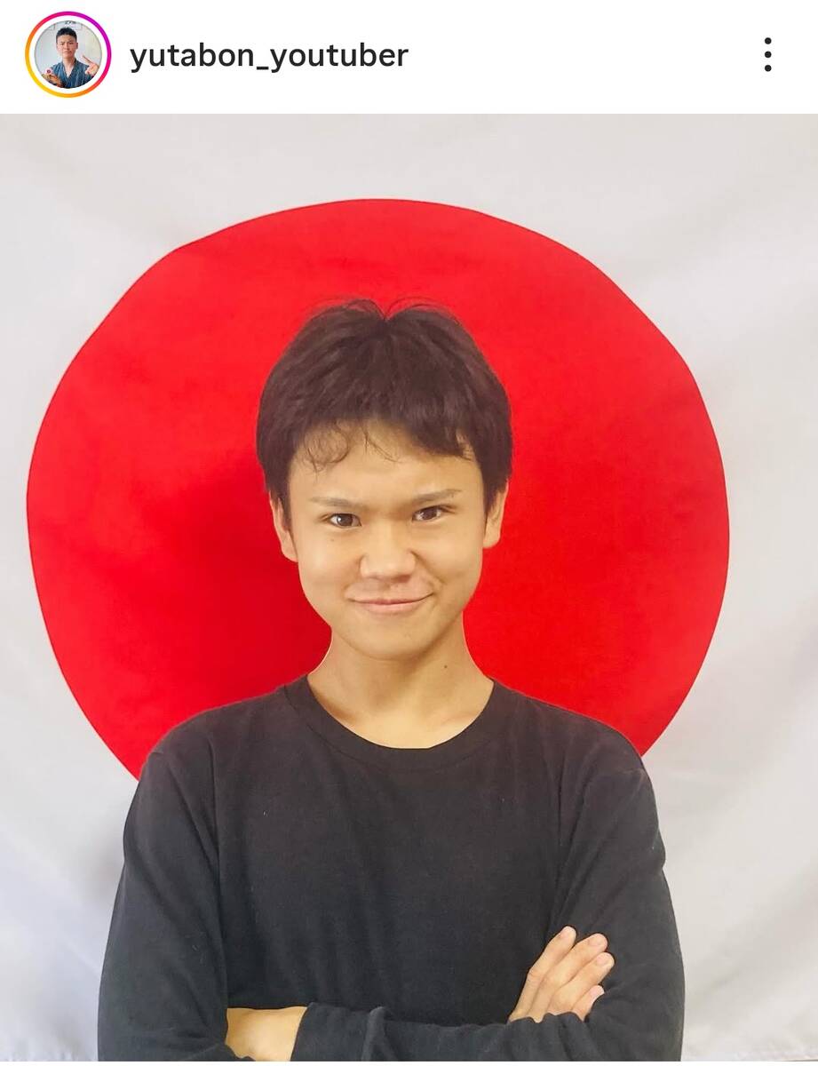 💥整容脸？车祸疑云全清！网红“变脸”真相震惊！