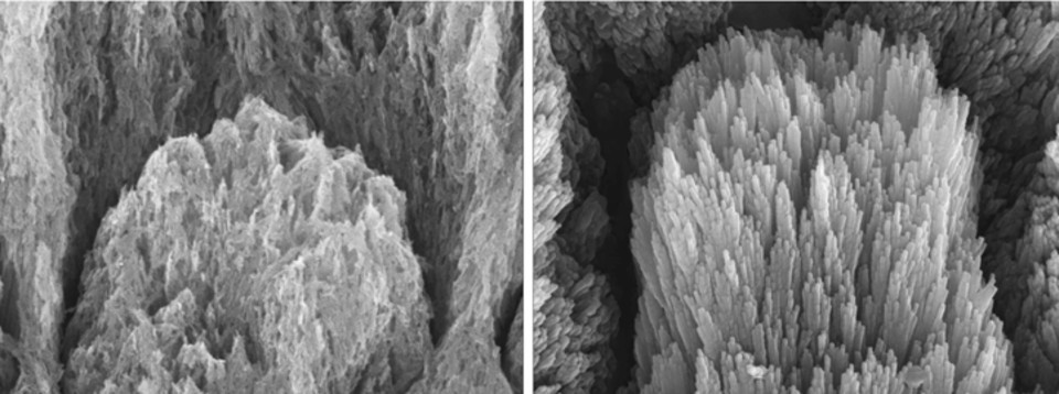 ✨告别蛀牙！牙齿“自愈”？神奇凝胶来了！