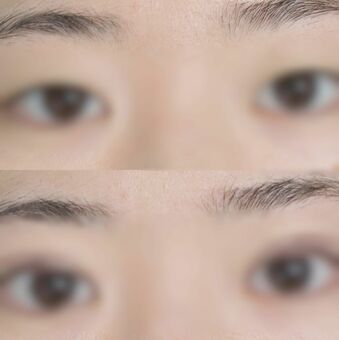 🎁孩子整容当生日礼？背后的“爱”与痛！