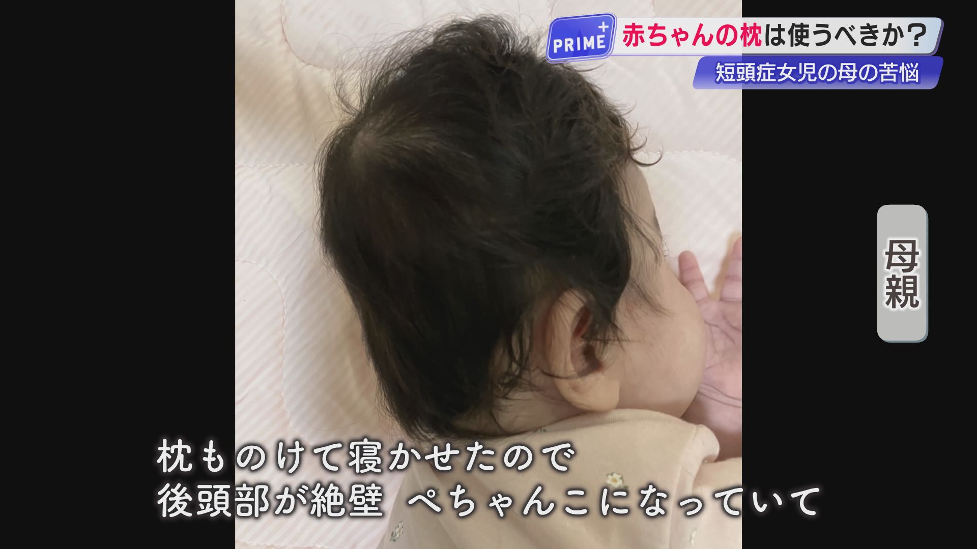 👶️ 别信“不需枕头”！宝宝头扁了，医生们吵翻了！